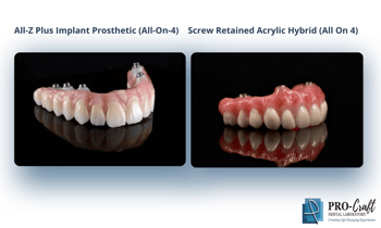 All-on-4 Case Selection Tips: When Zirconia Is the Best Option