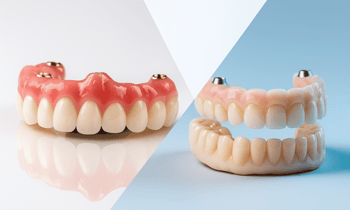 All-on-4 Case Selection Tips