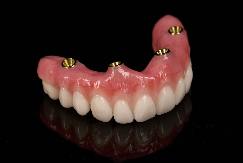 Screw Retained Acrylic Hybrid (All On 4)-1