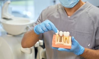 Dentist with implant case