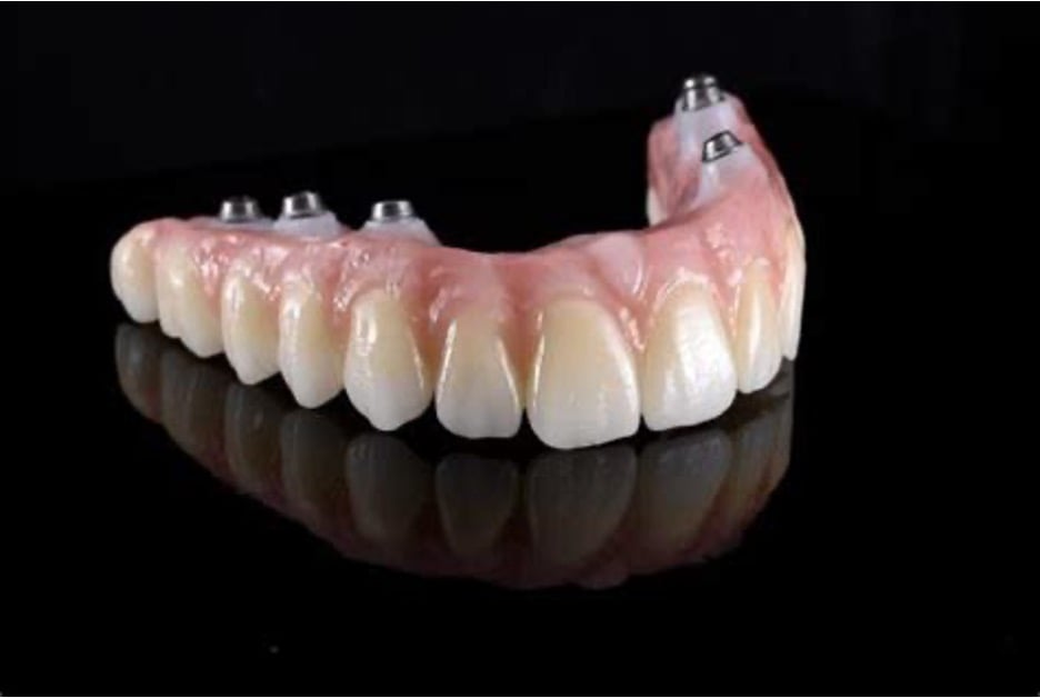 All Z Solid Zirconia All on 4 2