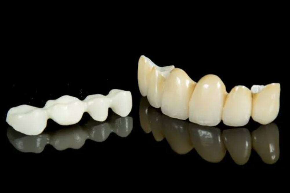 PRO Z Full Layered Zirconia Crowns