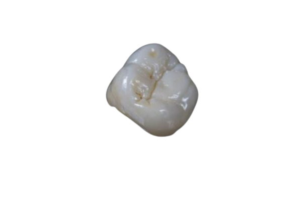 All-Z Zirconia Crown from PRO-Craft Dental Laboratory