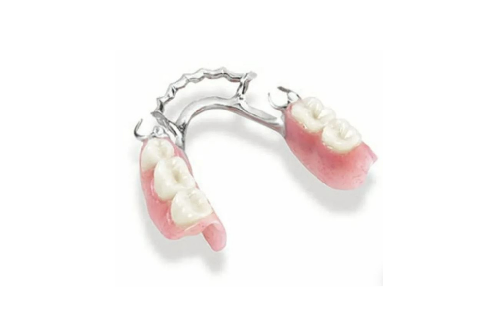 PRO-Craft Dental Lab's Partial Dentures fabricated with Vitallium