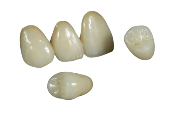 IPS E.max Crowns from PRO-Craft Dental Laboratory