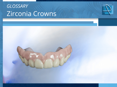 Zirconia Crowns: Definition, Benefits & Uses in Dentistry | Pro-Craft