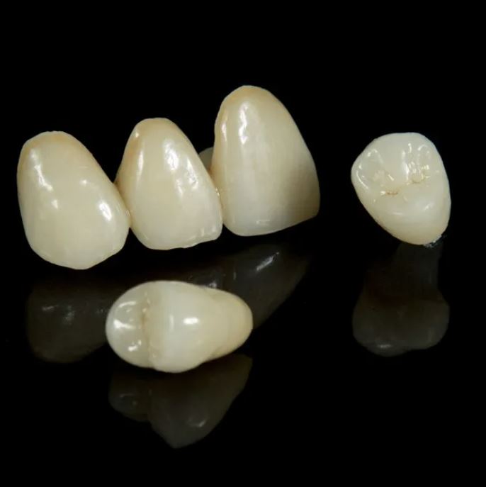 IPS e.max Crowns