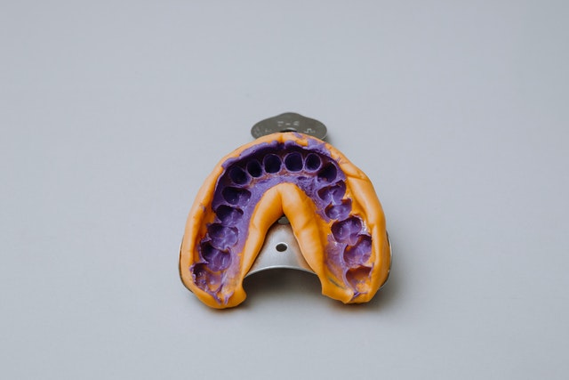 Clinical Predictability With Dual-arch Impressions Quad Trays Article | Pro-Craft